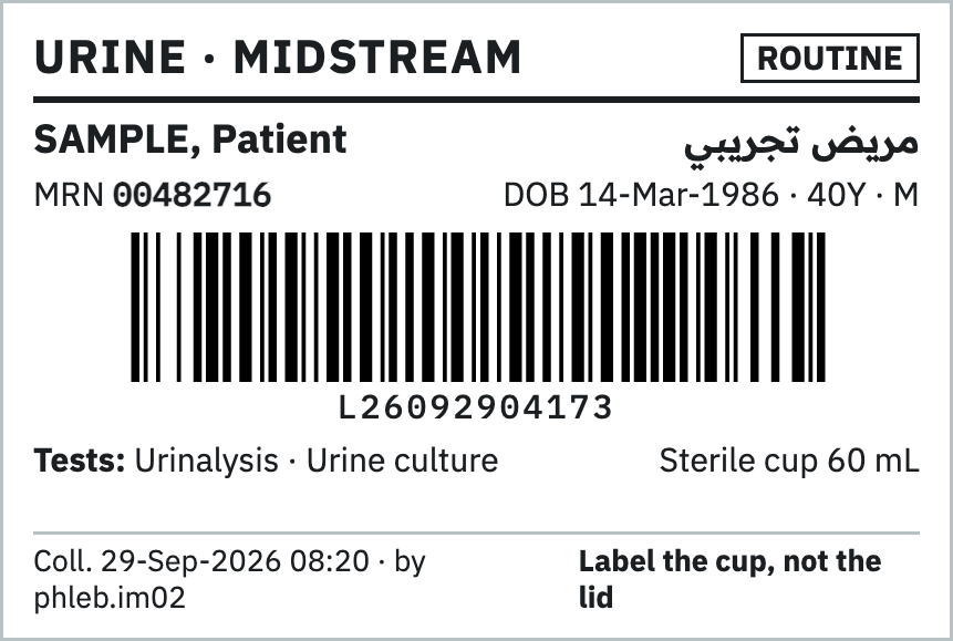 ملصق وعاء بول ببيانات المريض والباركود والفحوص